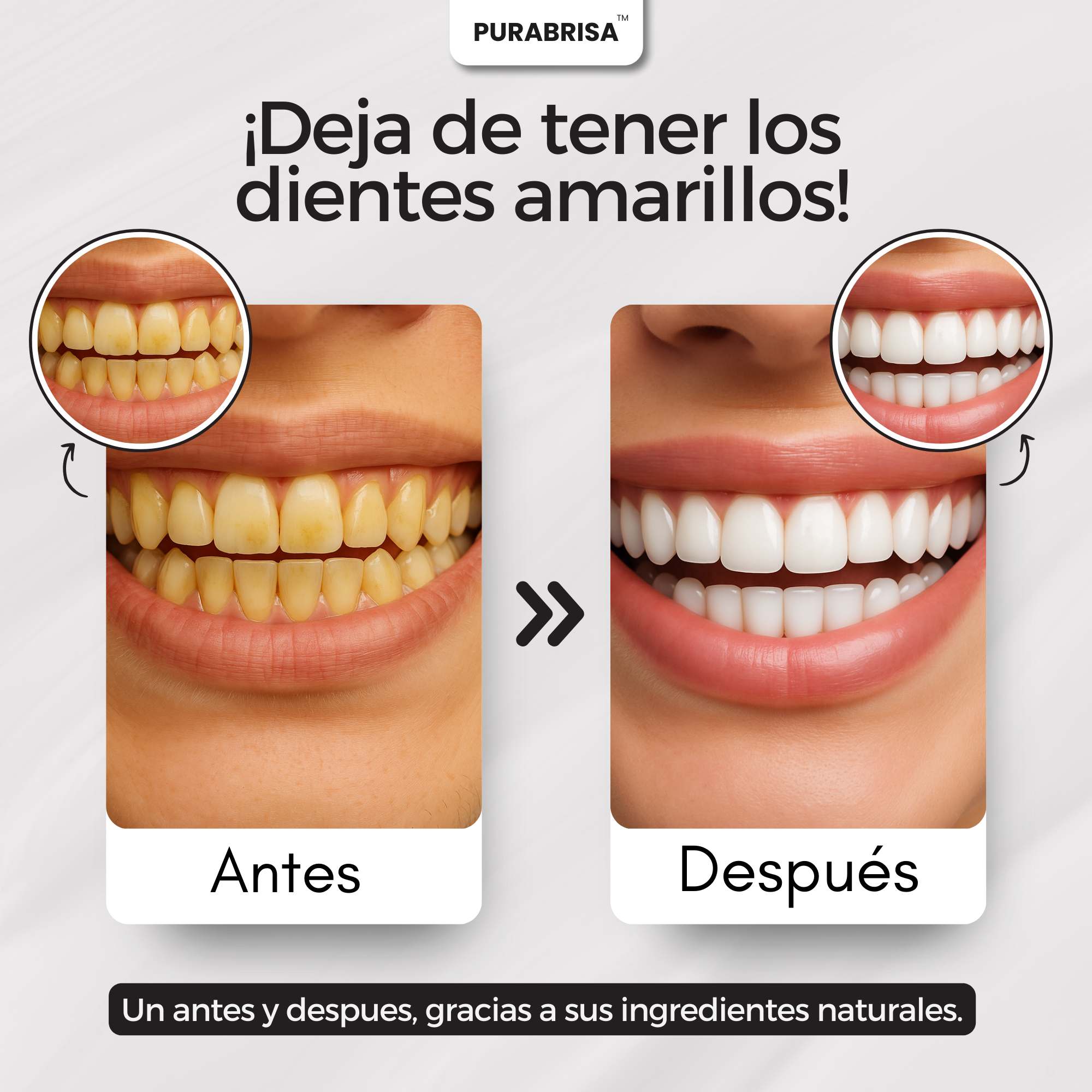 Tiras Blanqueadoras Profesionales - Blanquea 4X Más Sin Sensibilidad